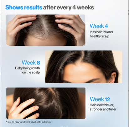 Be Bodywise Hair Growth Roll-On Serum for Men & Women | 3% Rosemary, 3% Redensyl, 2% AnaGain | Precision Scalp Applicator | Paraben/Sulphate-Free | Non-Oily | DHT Blocking