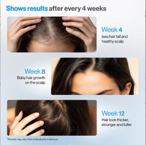 Be Bodywise Hair Growth Roll-On Serum for Men & Women | 3% Rosemary, 3% Redensyl, 2% AnaGain | Precision Scalp Applicator | Paraben/Sulphate-Free | Non-Oily | DHT Blocking