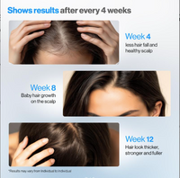 Be Bodywise Hair Growth Roll-On Serum for Men & Women | 3% Rosemary, 3% Redensyl, 2% AnaGain | Precision Scalp Applicator | Paraben/Sulphate-Free | Non-Oily | DHT Blocking